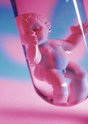 俄罗斯试管婴儿费用高吗？